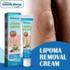 LIPOMA REMOVAL/RELIEF CREAM