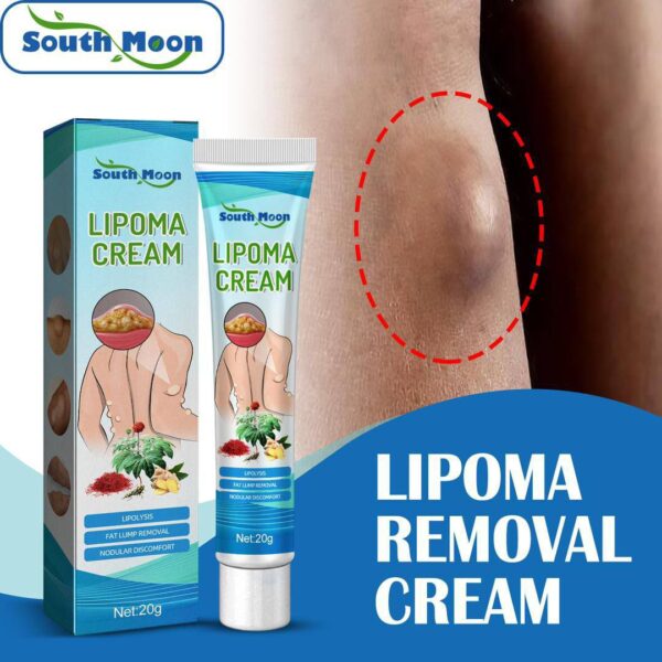 LIPOMA REMOVAL/RELIEF CREAM
