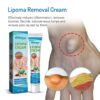 LIPOMA REMOVAL/RELIEF CREAM